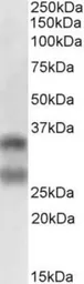 Anti-sRANKL antibody [12A668] used in Western Blot (WB). GTX13582