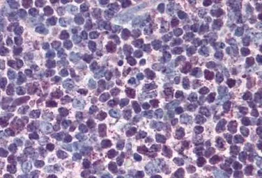 Anti-Caspase 3 antibody [31A1067] used in IHC (Paraffin sections) (IHC-P). GTX13585