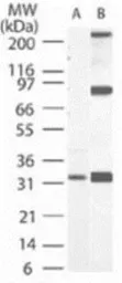 Anti-Caspase 3 antibody [31A1067] used in Western Blot (WB). GTX13585