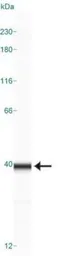 Anti-Caspase 3 antibody [31A1067] used in Western Blot (WB). GTX13585
