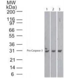 Anti-Caspase 3 antibody [31A1067] used in Western Blot (WB). GTX13585