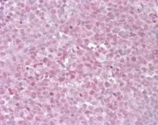 Anti-TRF2 antibody used in IHC (Paraffin sections) (IHC-P). GTX13589