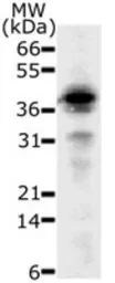 Anti-DFFB antibody [36A349] used in Western Blot (WB). GTX13592