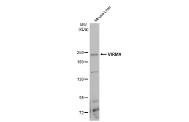 Anti-VIRMA antibody used in Western Blot (WB). GTX135924