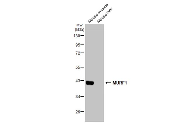 Anti-MURF1 antibody used in Western Blot (WB). GTX135929