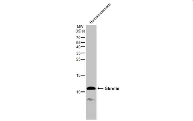 Anti-Ghrelin antibody used in Western Blot (WB). GTX135930