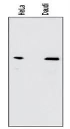 Anti-NFkB p65 antibody [112A1021] used in Western Blot (WB). GTX13594