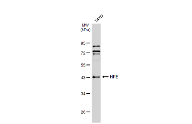 Anti-HFE antibody used in Western Blot (WB). GTX135988