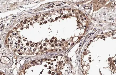 Anti-HFE antibody used in IHC (Paraffin sections) (IHC-P). GTX135988