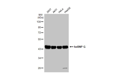 Anti-hnRNP G antibody used in Western Blot (WB). GTX135993