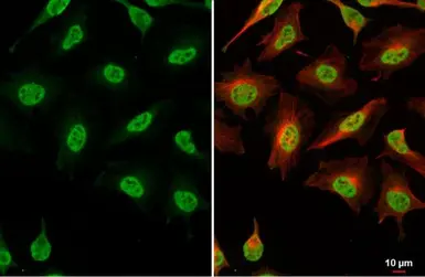 Anti-hnRNP G antibody used in Immunocytochemistry/ Immunofluorescence (ICC/IF). GTX135993