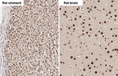 Anti-hnRNP G antibody used in IHC (Paraffin sections) (IHC-P). GTX135993