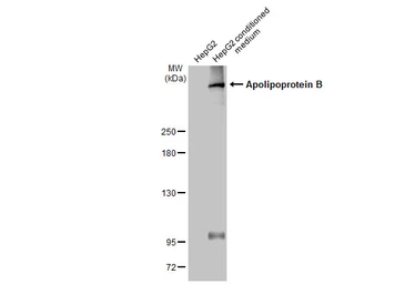 Anti-Apolipoprotein B antibody used in Western Blot (WB). GTX135994