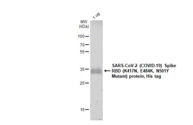 SARS-CoV-2 (COVID-19) Spike RBD Protein, B.1.351 / Beta variant, His tag (active). GTX136022-pro