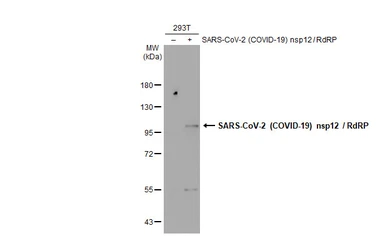 Anti-SARS-CoV-2 (COVID-19) nsp12 / RdRP antibody used in Western Blot (WB). GTX136049