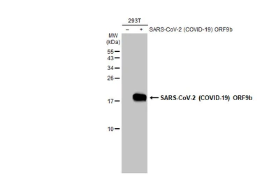 Anti-SARS-CoV-2 (COVID-19) ORF9b antibody used in Western Blot (WB). GTX136053