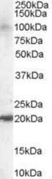 Anti-JWA antibody, C-term used in Western Blot (WB). GTX13618