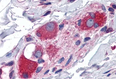 Anti-JWA antibody, C-term used in IHC (Paraffin sections) (IHC-P). GTX13618