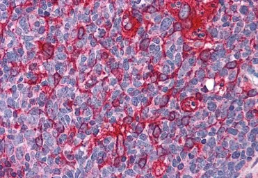 Anti-JWA antibody, C-term used in IHC (Paraffin sections) (IHC-P). GTX13618