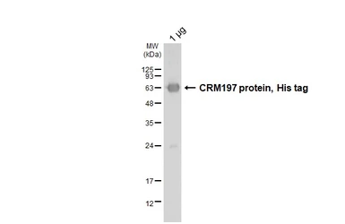 CRM197 protein, His tag. GTX136284-pro