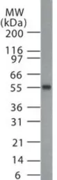 Anti-MBD1 antibody used in Western Blot (WB). GTX13648