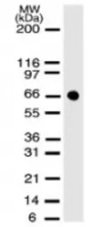 Anti-PDCD7 antibody [46C713.2.1] used in Western Blot (WB). GTX13650