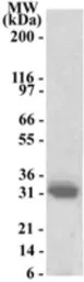 Anti-INHAT2 antibody used in Western Blot (WB). GTX13658