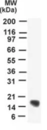 Anti-UBE2N antibody used in Western Blot (WB). GTX13663