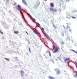 Anti-TEM7 antibody [197C193(IM193)] used in IHC (Paraffin sections) (IHC-P). GTX13667