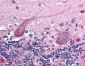 Anti-TEM7 antibody [197C193(IM193)] used in IHC (Paraffin sections) (IHC-P). GTX13667