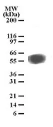 Anti-TEM7 antibody [197C193(IM193)] used in Western Blot (WB). GTX13667