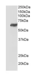 Anti-TEM7 antibody [197C193(IM193)] used in Western Blot (WB). GTX13667