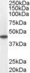 Anti-ACADM antibody, C-term used in Western Blot (WB). GTX13677