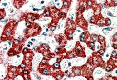 Anti-ACADM antibody, C-term used in IHC (Paraffin sections) (IHC-P). GTX13677
