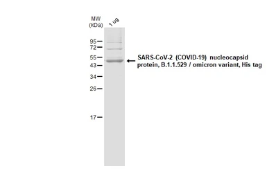 SARS-CoV-2 (COVID-19) Nucleocapsid protein, Omicron / BA.1 variant, His tag. GTX136779-pro