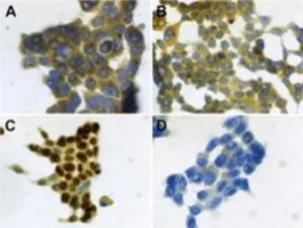 Anti-Psoriasin antibody [47C1068] used in Immunocytochemistry/ Immunofluorescence (ICC/IF). GTX13680