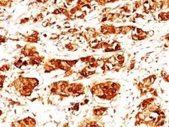 Anti-Psoriasin antibody [47C1068] used in IHC (Paraffin sections) (IHC-P). GTX13680