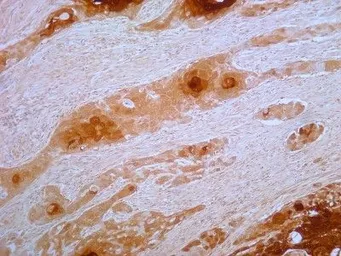 Anti-Psoriasin antibody [47C1068] used in IHC (Paraffin sections) (IHC-P). GTX13680