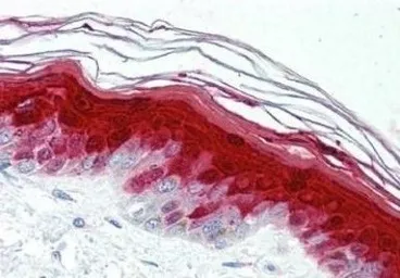 Anti-Psoriasin antibody [47C1068] used in IHC (Paraffin sections) (IHC-P). GTX13680