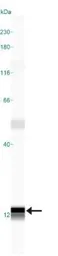 Anti-Psoriasin antibody [47C1068] used in Western Blot (WB). GTX13680