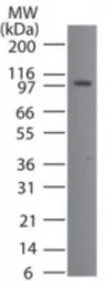 Anti-Porimin antibody used in Western Blot (WB). GTX13693