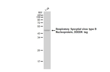 Respiratory Syncytial virus type B Nucleoprotein, DDDDK tag. GTX136931-pro