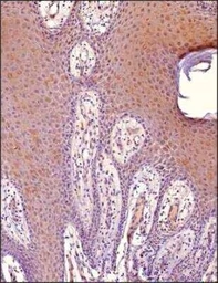 Anti-MITF antibody [21D1418] used in IHC (Paraffin sections) (IHC-P). GTX13703