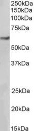 Anti-MITF antibody [21D1418] used in Western Blot (WB). GTX13703