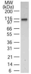 Anti-DNA ligase I antibody used in Western Blot (WB). GTX13706