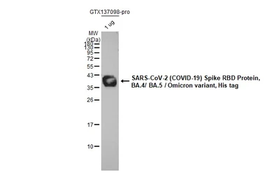 SARS-CoV-2 (COVID-19) Spike RBD Protein, Omicron / BA.4 / BA.5 variant, His tag. GTX137098-pro