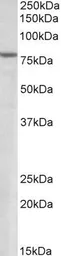 Anti-SETDB2 antibody, N-term used in Western Blot (WB). GTX13712