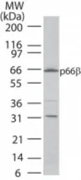 Anti-p66 beta antibody used in Western Blot (WB). GTX13713