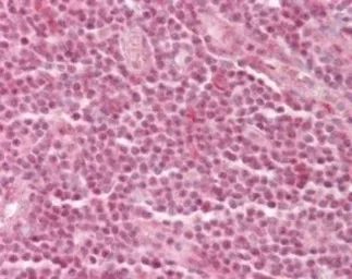 Anti-p66 alpha antibody used in IHC (Paraffin sections) (IHC-P). GTX13714
