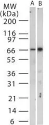 Anti-TRAF3 antibody used in Western Blot (WB). GTX13721